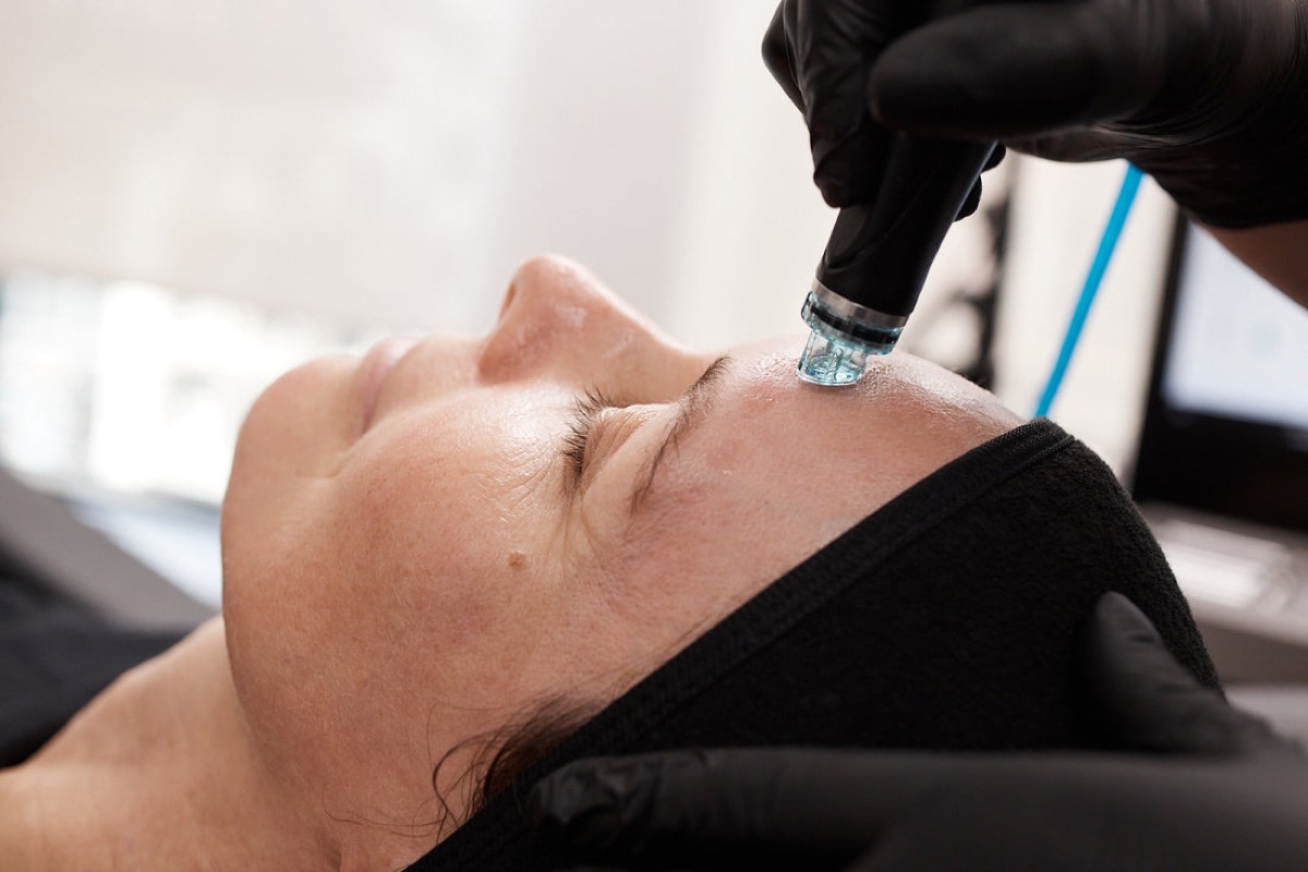 A gloved practitioner uses the Hydrafacial vortex tip to painlessly extract pores on a client's forehead