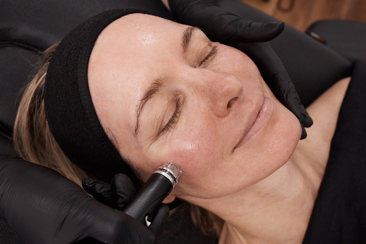 A Hydrafacial device hydrating a client's skin