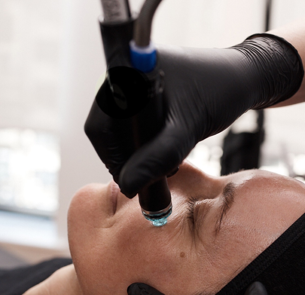 A Hydrafacial handpiece with a turquoise tip gently resurfacing a client's skin